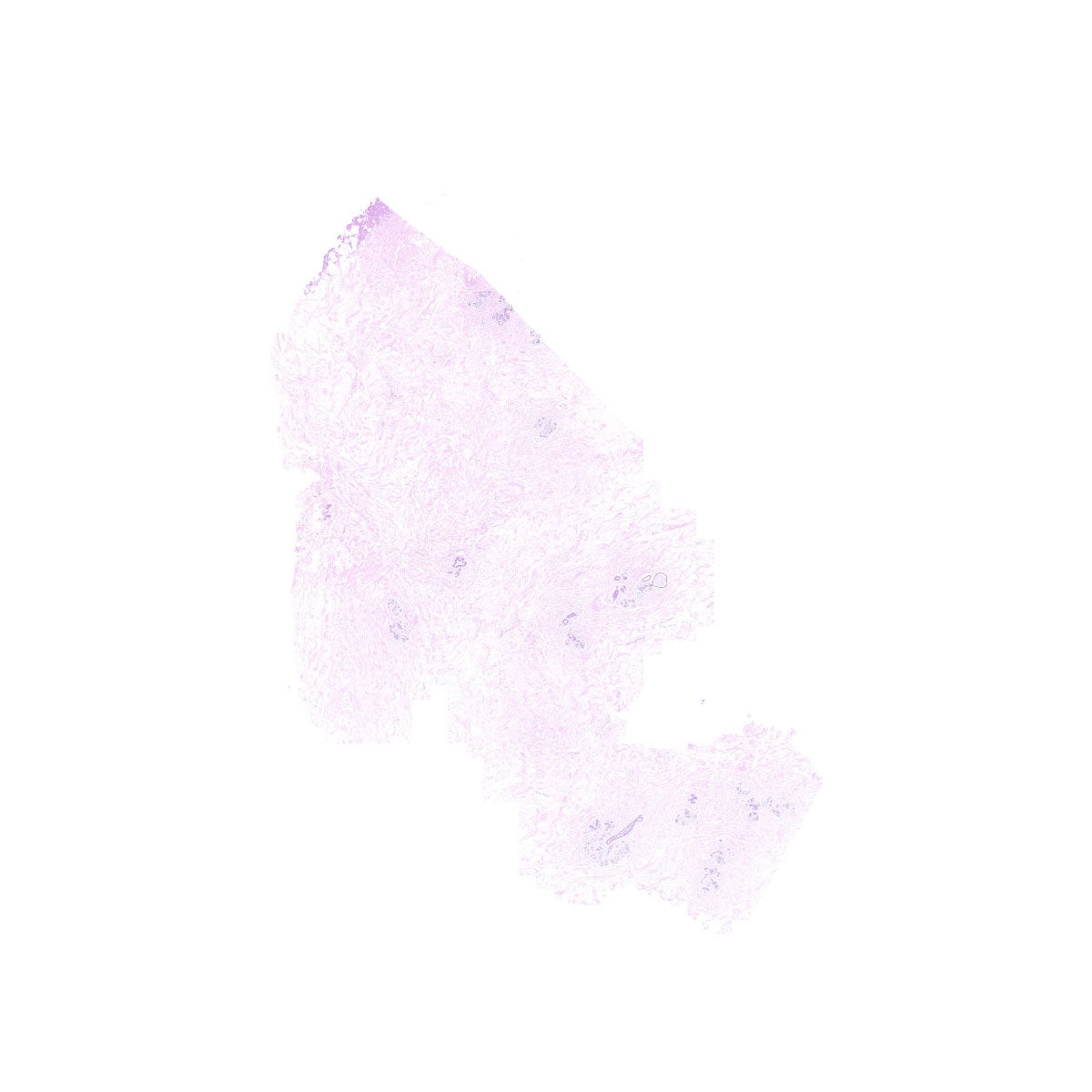 Human FFPE NAT Breast Tissue HuN-06-0069B