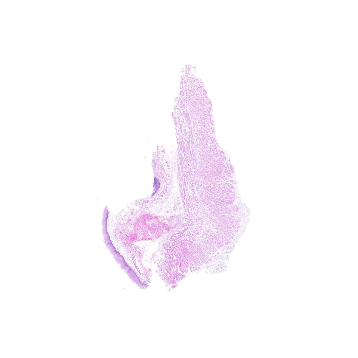 Human FFPE NAT Esophagus Tissue HuN-09-0007A