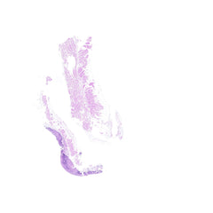 Human FFPE NAT Esophagus Tissue HuN-09-0009