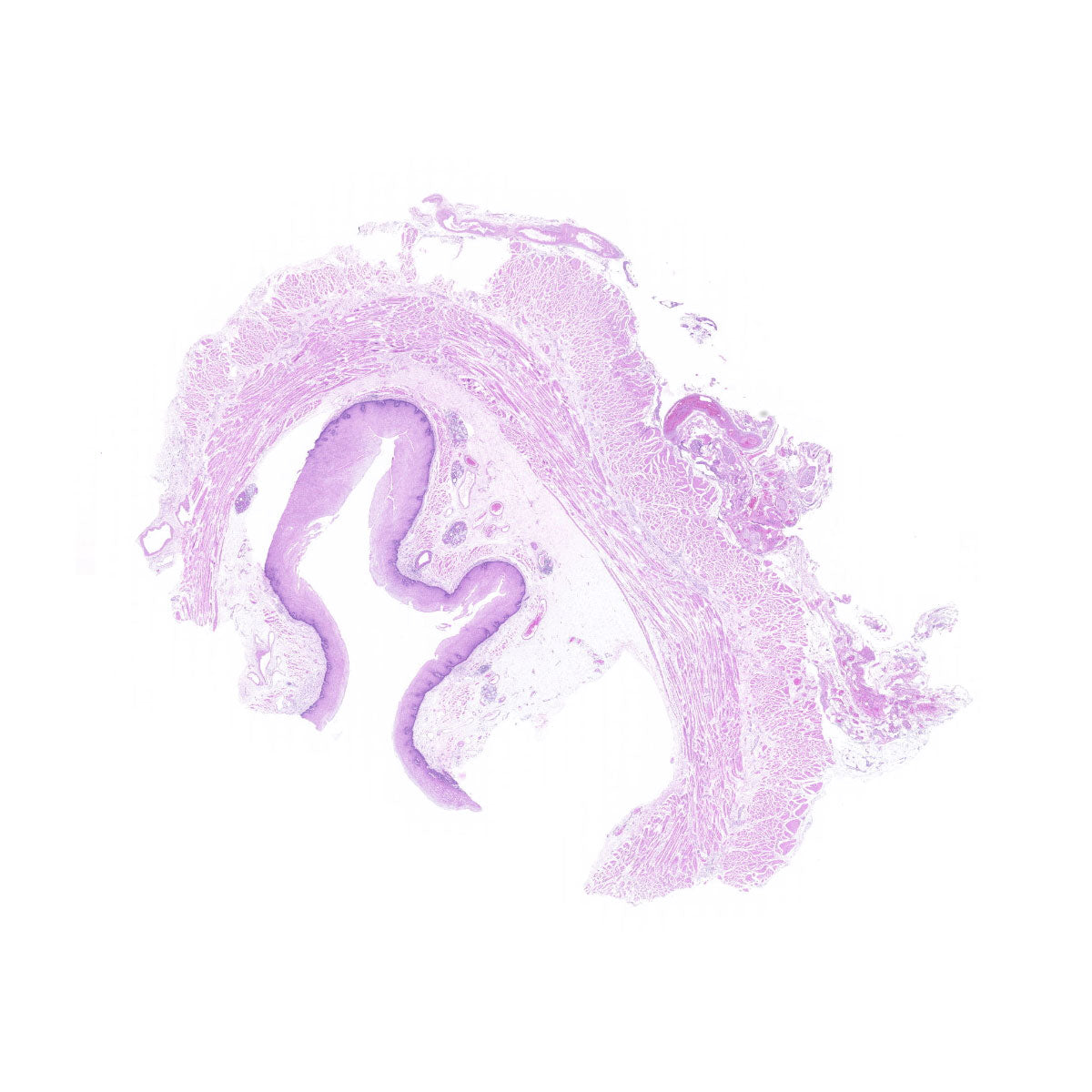 Human FFPE NAT Esophagus Tissue HuN-09-0010
