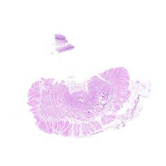 Human FFPE NAT Esophagus Tissue HuN-09-0011A