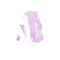 Human FFPE NAT Esophagus Tissue HuN-09-0012A