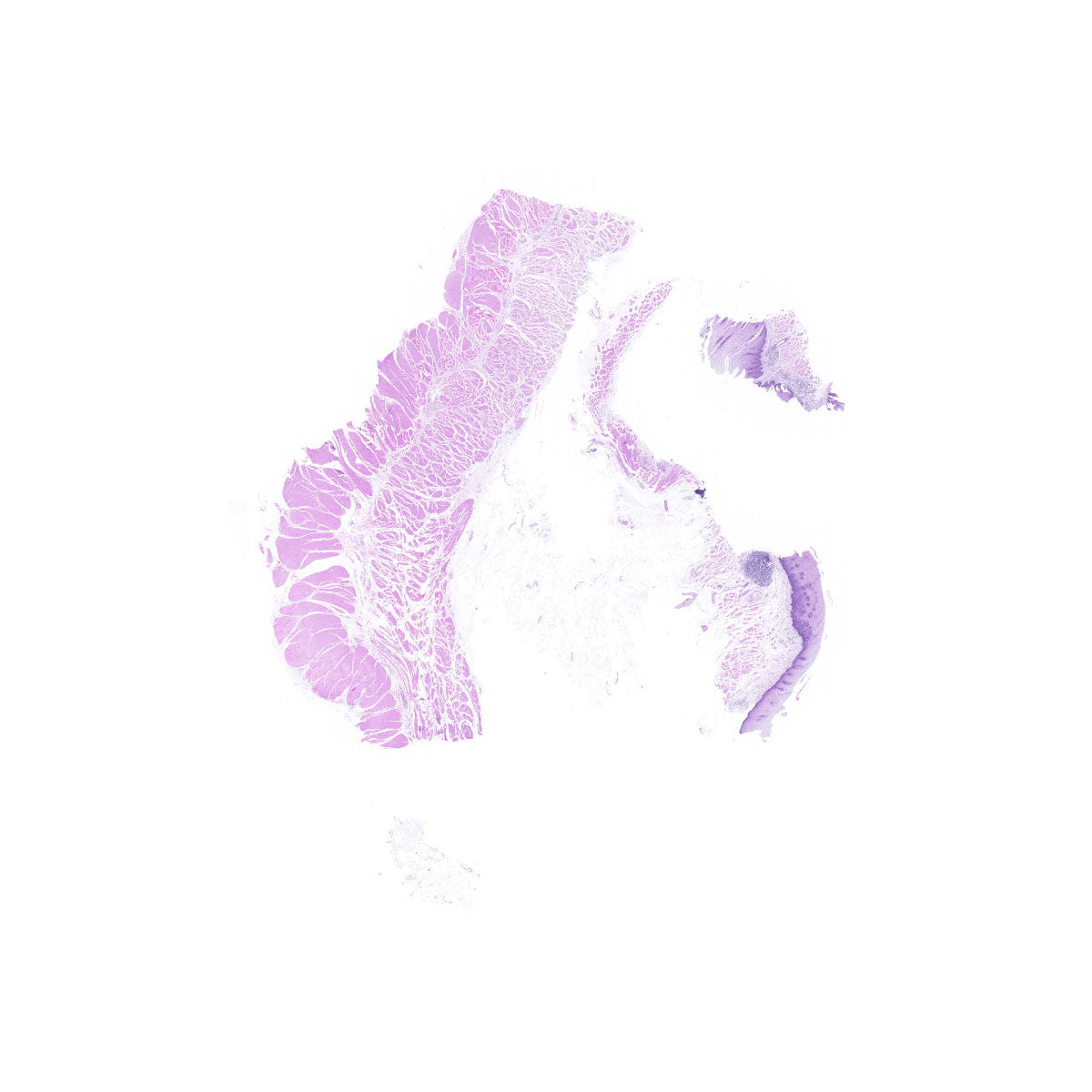 Human FFPE NAT Esophagus Tissue HuN-09-0012B