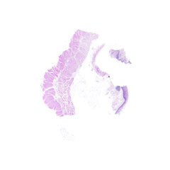 Human FFPE NAT Esophagus Tissue HuN-09-0012B