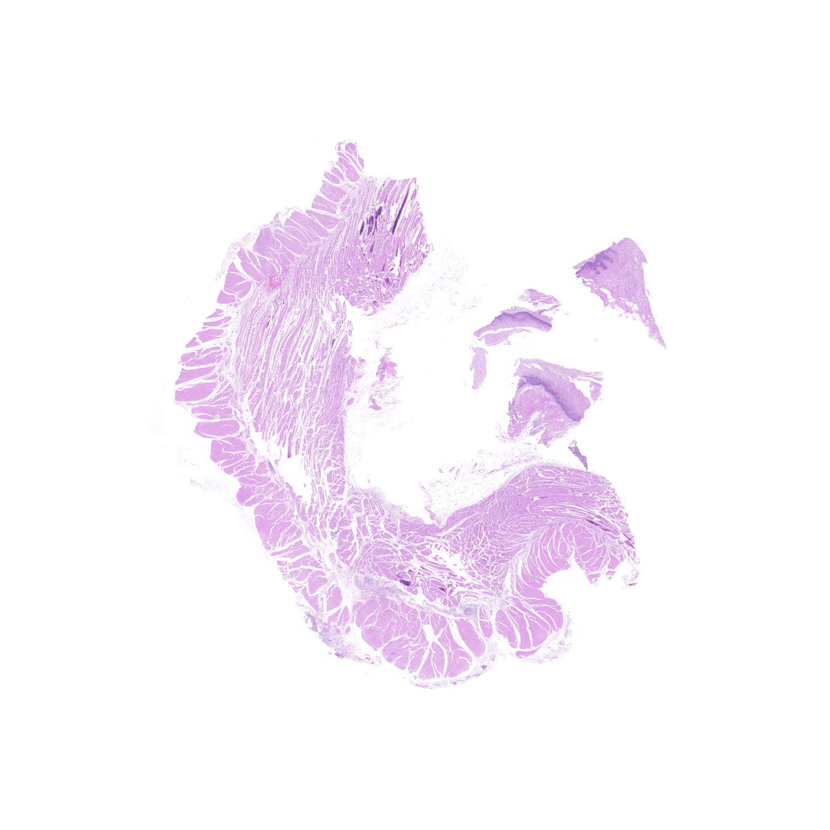 Human FFPE NAT Esophagus Tissue HuN-09-0013