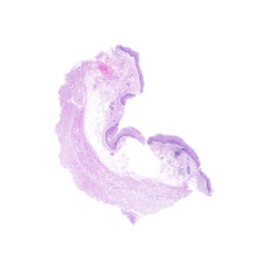 Human FFPE NAT Esophagus Tissue HuN-09-0018