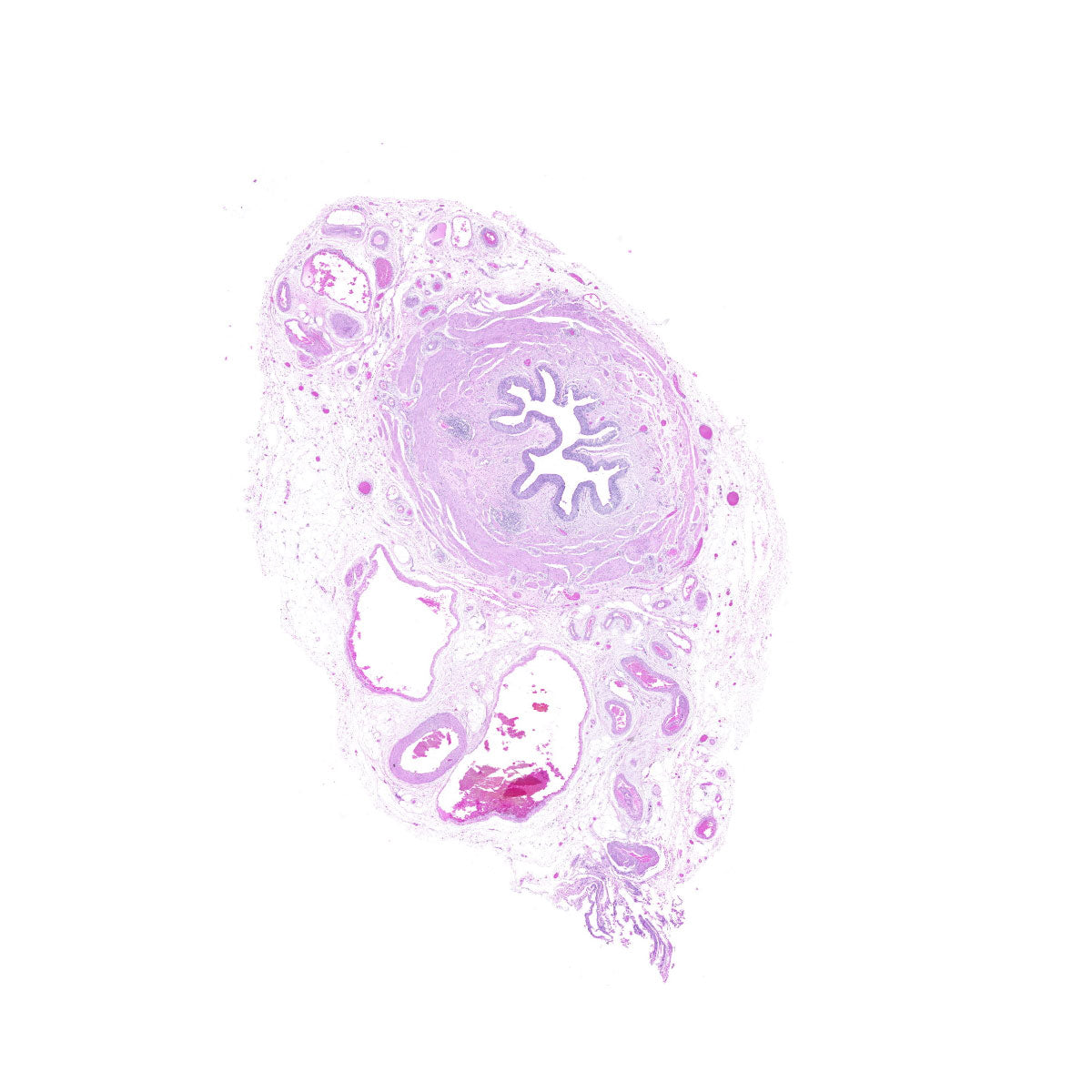 Human FFPE NAT Ureter Tissue HuN-10-0007