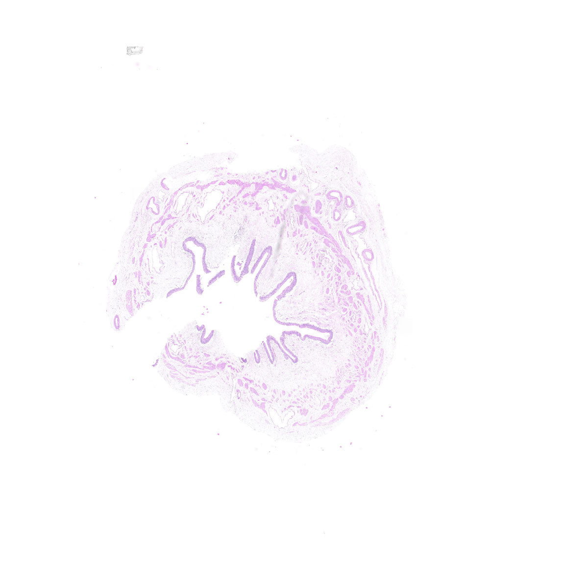 Human FFPE NAT Ureter Tissue HuN-10-0008