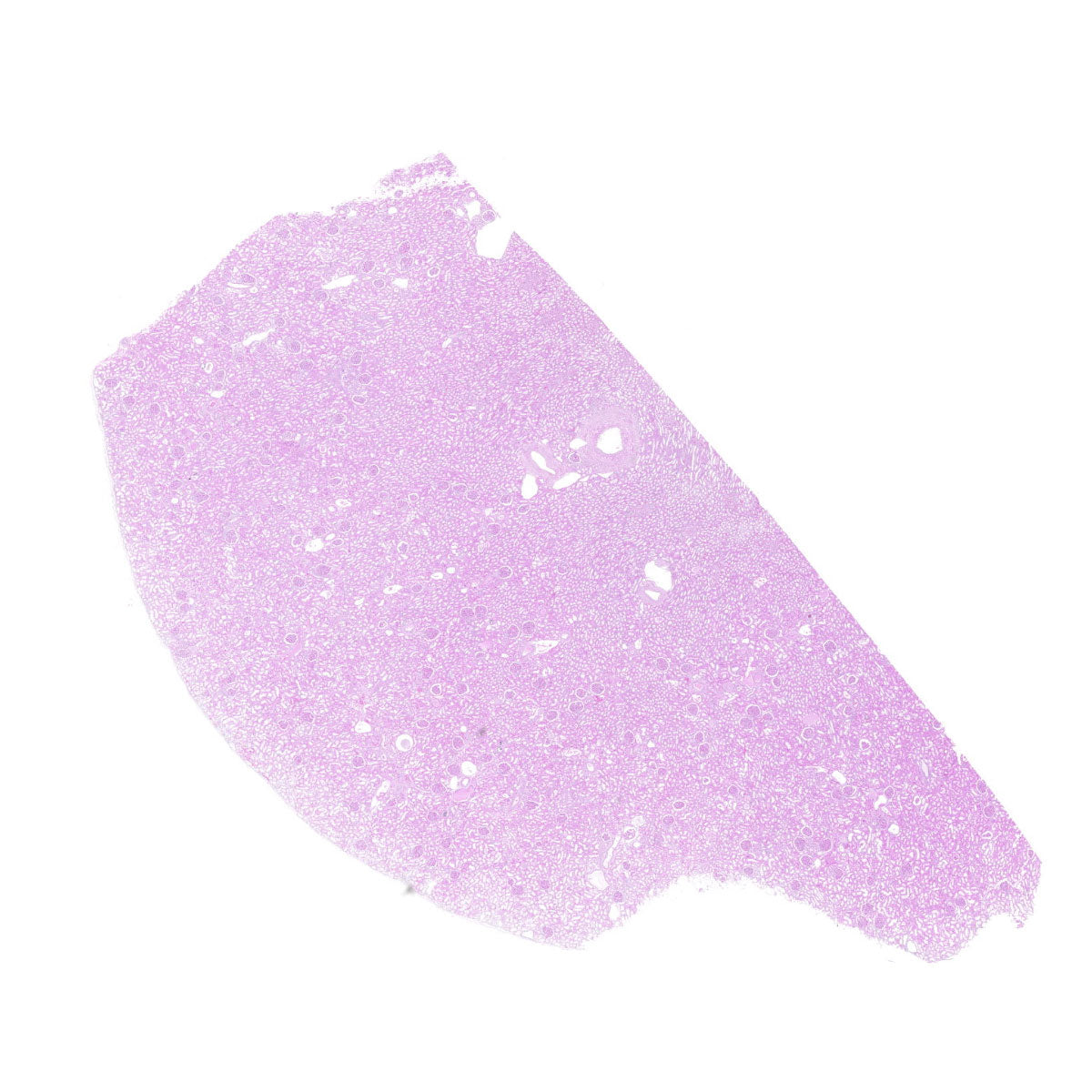 Human FFPE NAT Kidney Tissue HuN-12-0070A