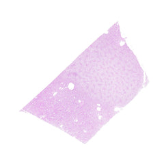 Human FFPE NAT Kidney Tissue HuN-12-0070B