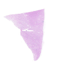Human FFPE NAT Kidney Tissue HuN-12-0071