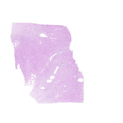 Human FFPE NAT Kidney Tissue HuN-12-0072