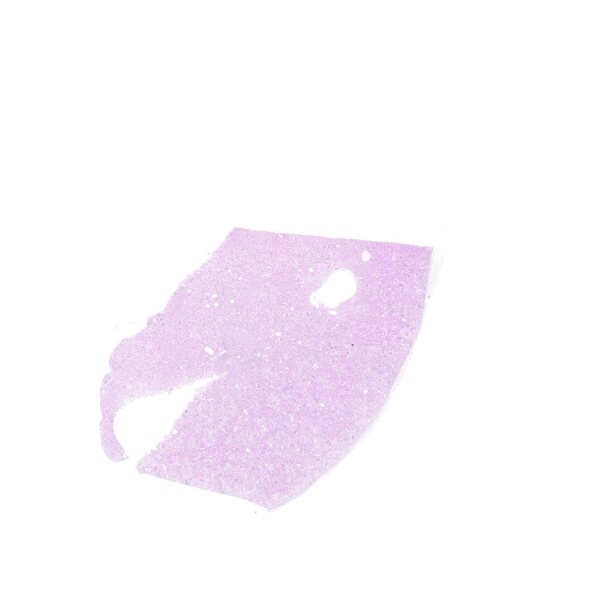 Human FFPE NAT Kidney Tissue HuN-12-0073