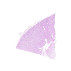 Human FFPE NAT Kidney Tissue HuN-12-0074