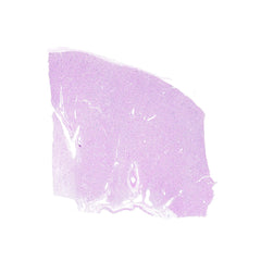 Human FFPE NAT Kidney Tissue HuN-12-0075