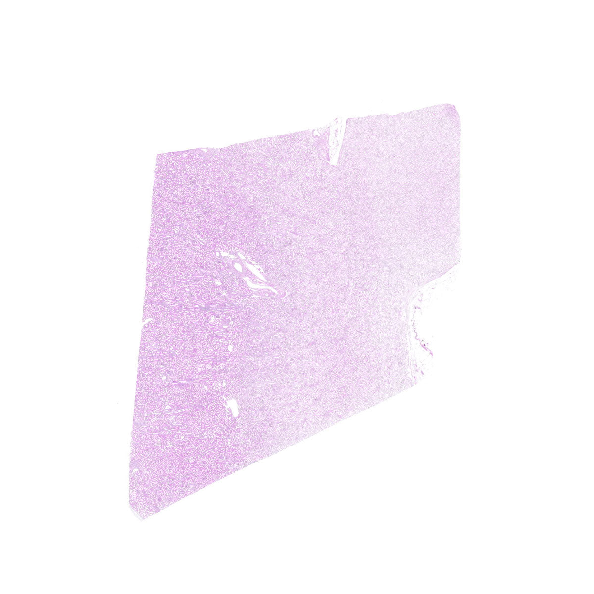 Human FFPE NAT Kidney Tissue HuN-12-0076A