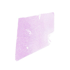 Human FFPE NAT Kidney Tissue HuN-12-0076A