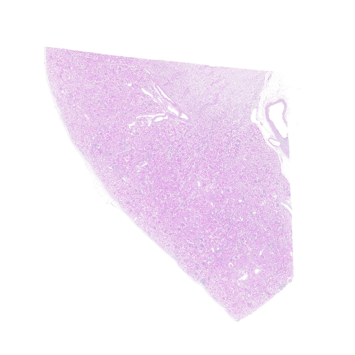 Human FFPE NAT Kidney Tissue HuN-12-0076B