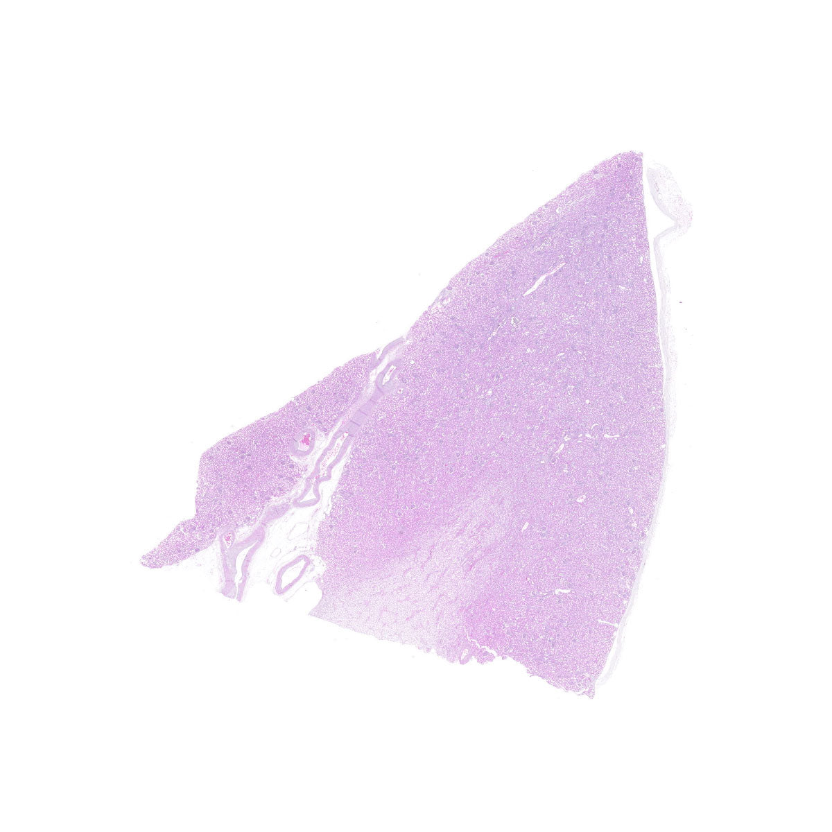 Human FFPE NAT Kidney Tissue HuN-12-0078