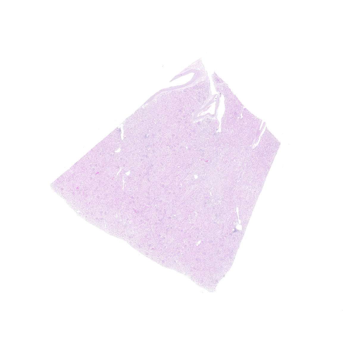 Human FFPE NAT Kidney Tissue HuN-12-0082A