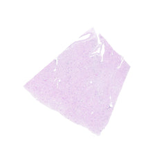 Human FFPE NAT Kidney Tissue HuN-12-0082A