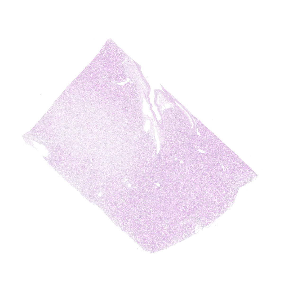 Human FFPE NAT Kidney Tissue HuN-12-0082B