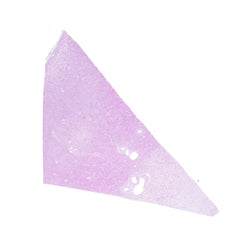 Human FFPE NAT Kidney Tissue HuN-12-0083A