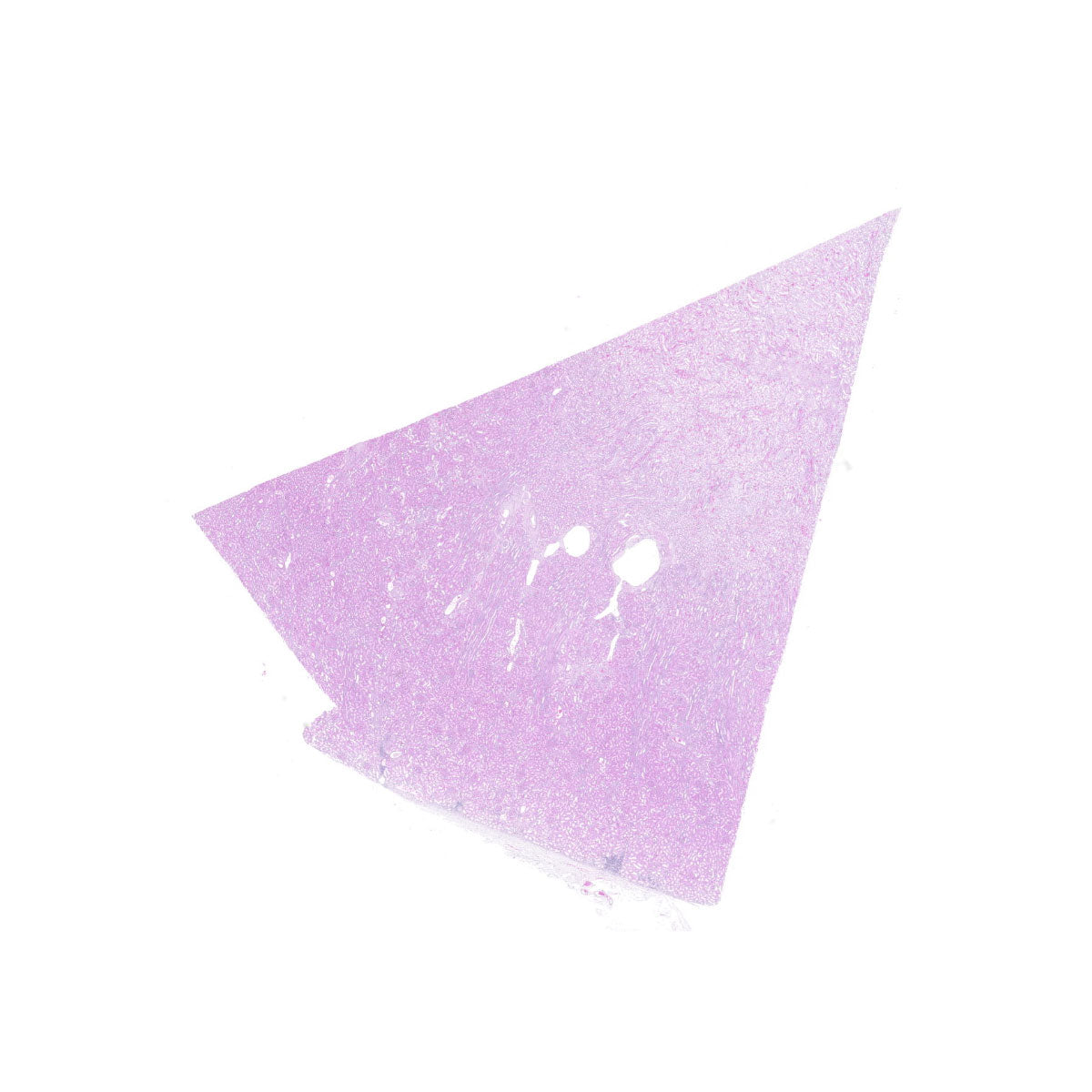 Human FFPE NAT Kidney Tissue HuN-12-0083B