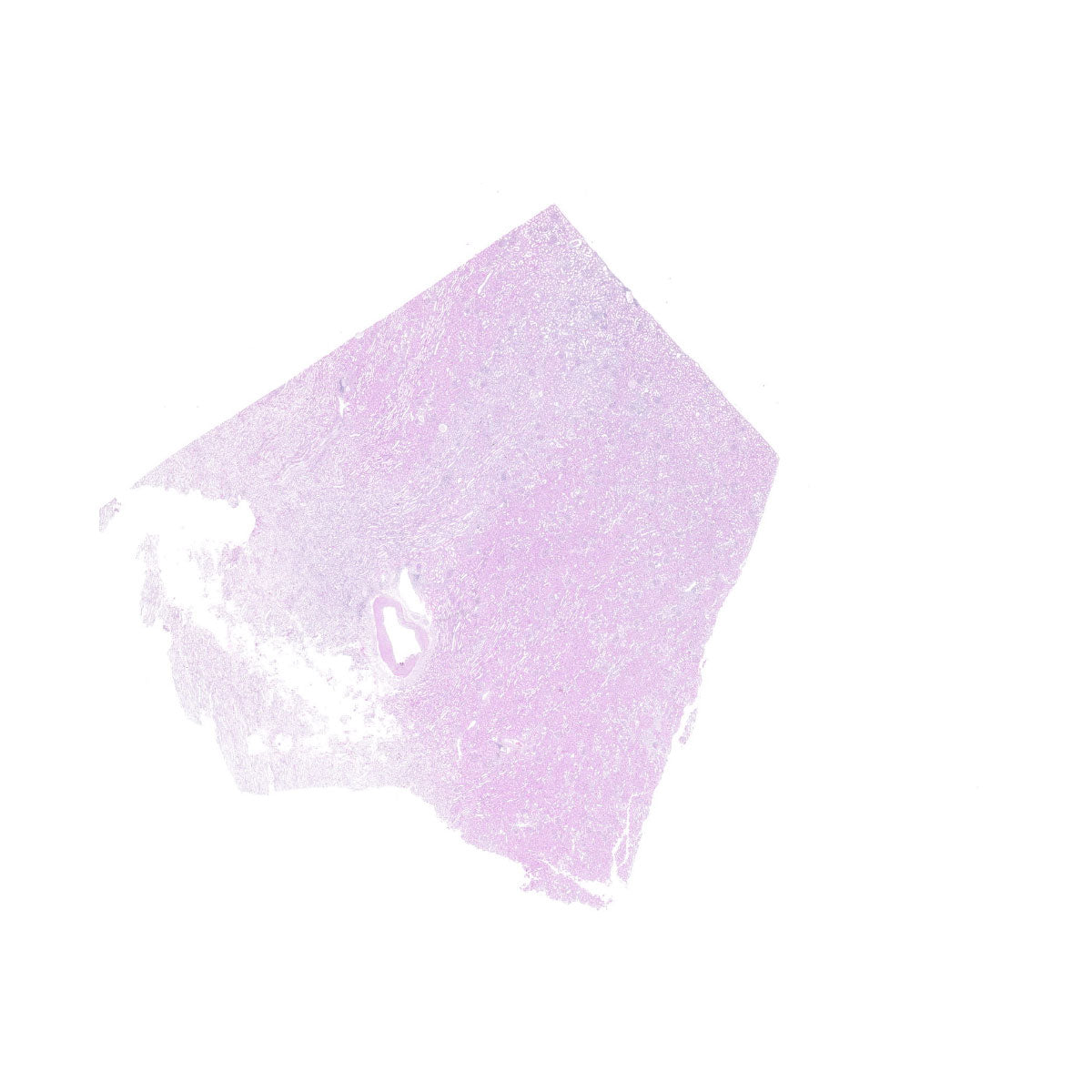 Human FFPE NAT Kidney Tissue HuN-12-0084A