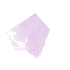 Human FFPE NAT Kidney Tissue HuN-12-0084A