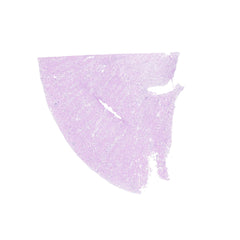 Human FFPE NAT Kidney Tissue HuN-12-0084B