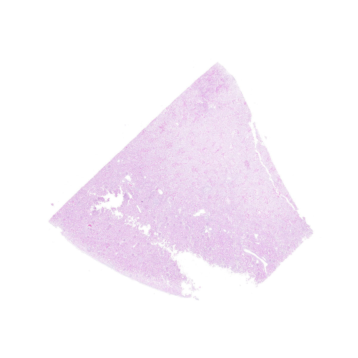 Human FFPE NAT Kidney Tissue HuN-12-0085A