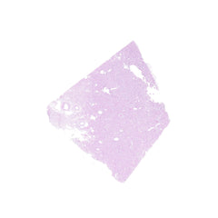 Human FFPE NAT Kidney Tissue HuN-12-0085B