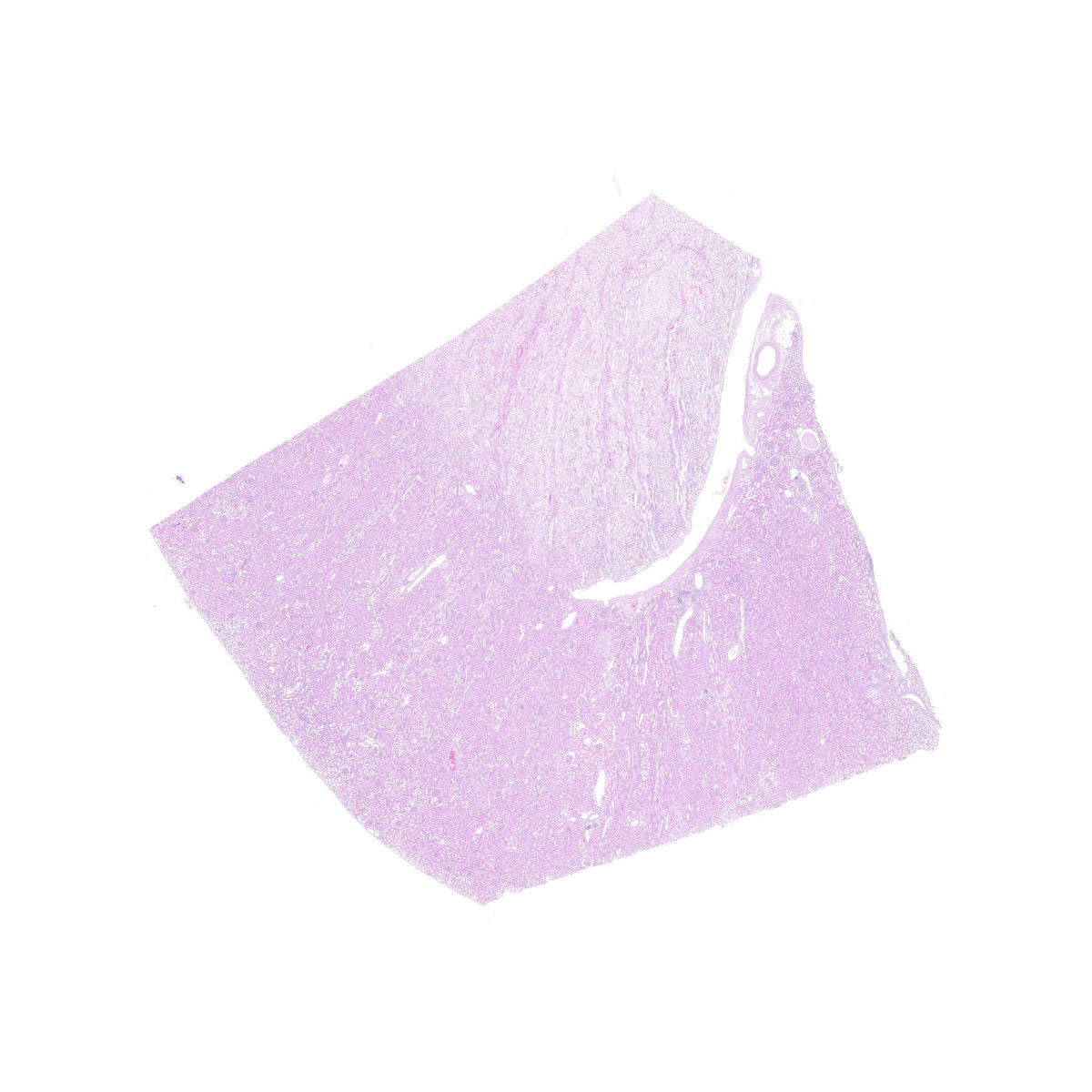 Human FFPE NAT Kidney Tissue HuN-12-0086A
