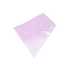 Human FFPE NAT Kidney Tissue HuN-12-0086B