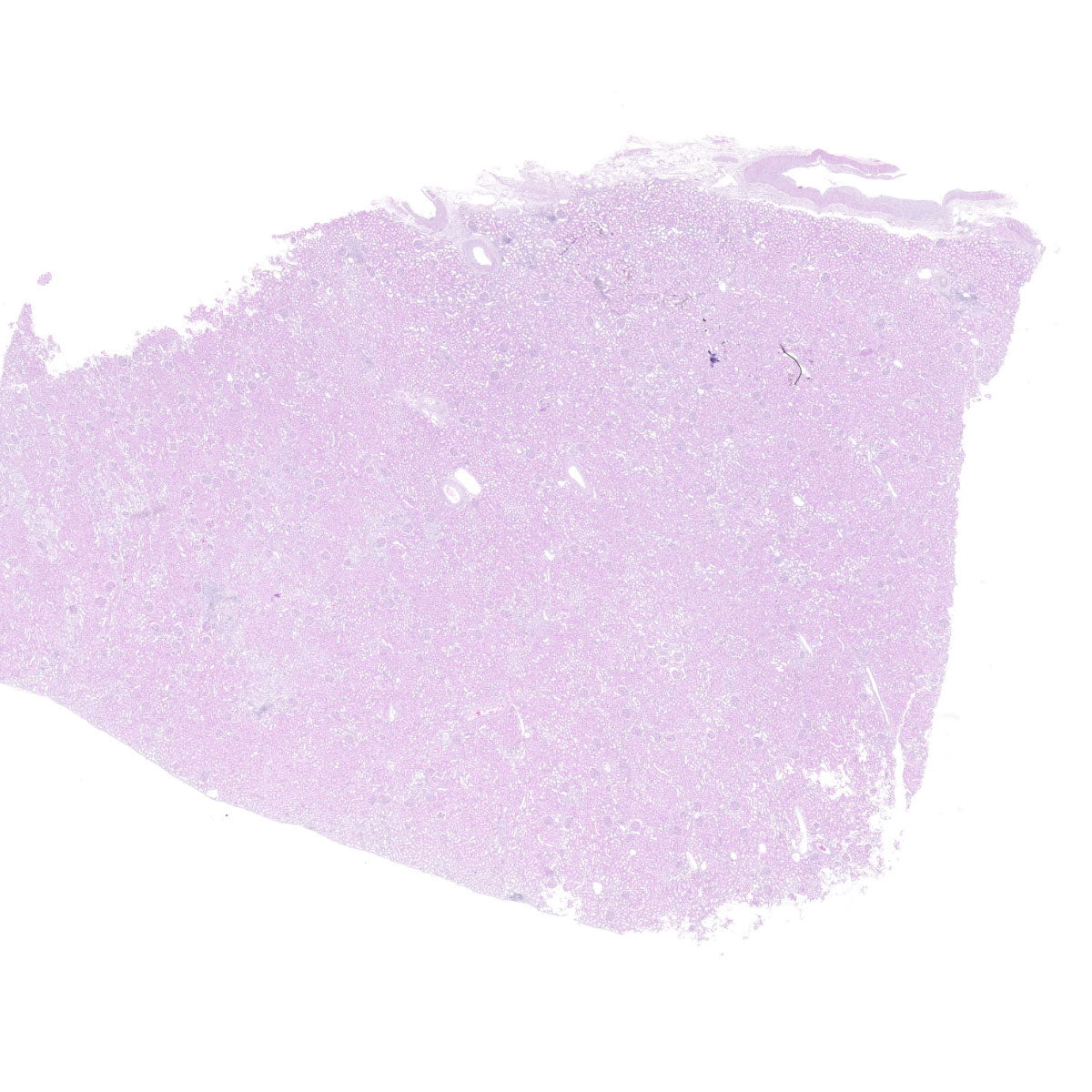 Human FFPE NAT Kidney Tissue HuN-12-0087