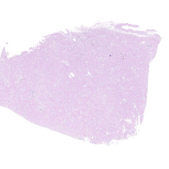 Human FFPE NAT Kidney Tissue HuN-12-0087