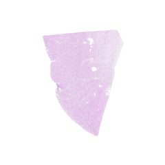 Human FFPE NAT Kidney Tissue HuN-12-0088A
