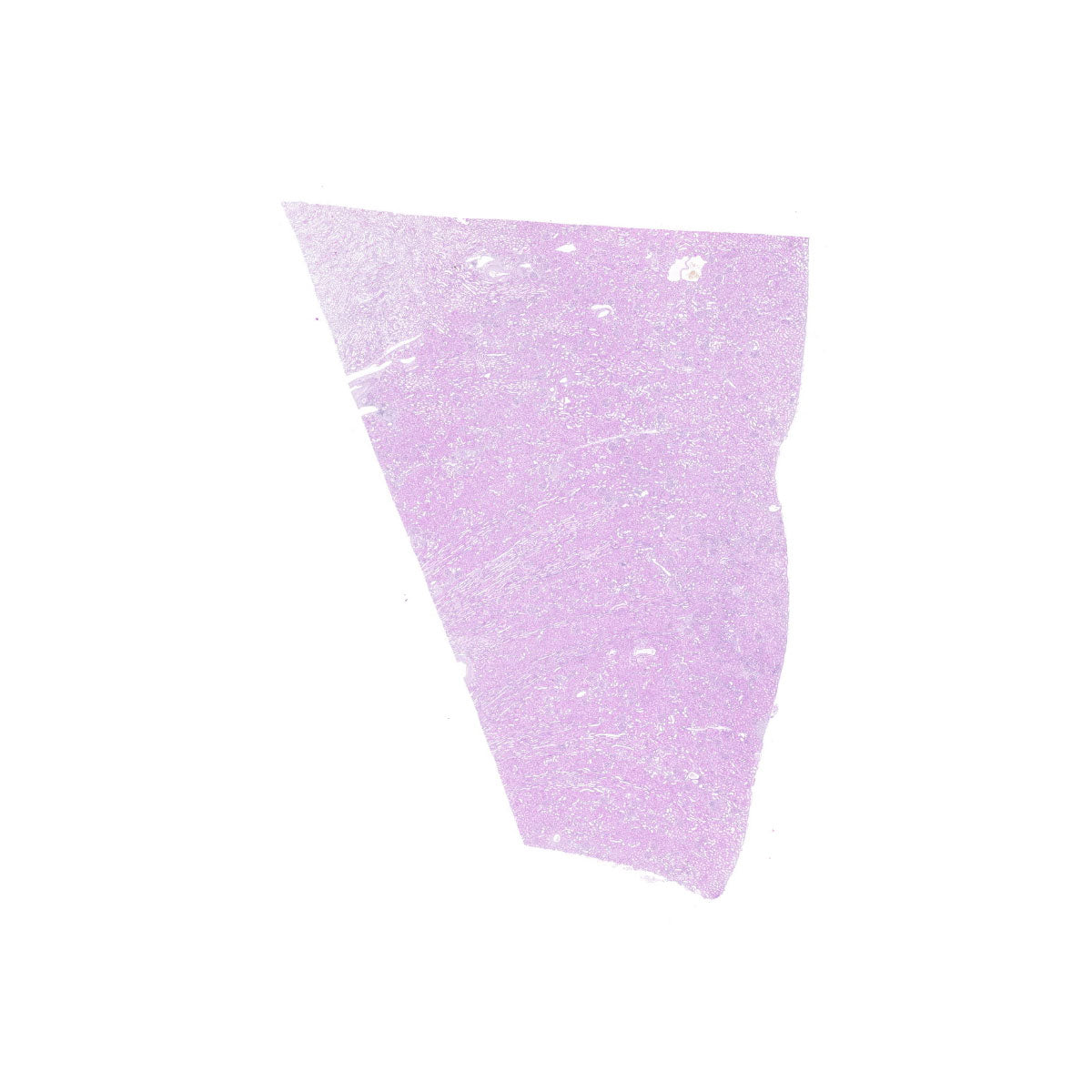 Human FFPE NAT Kidney Tissue HuN-12-0088B