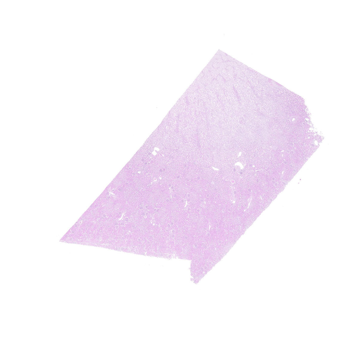 Human FFPE NAT Kidney Tissue HuN-12-0089B
