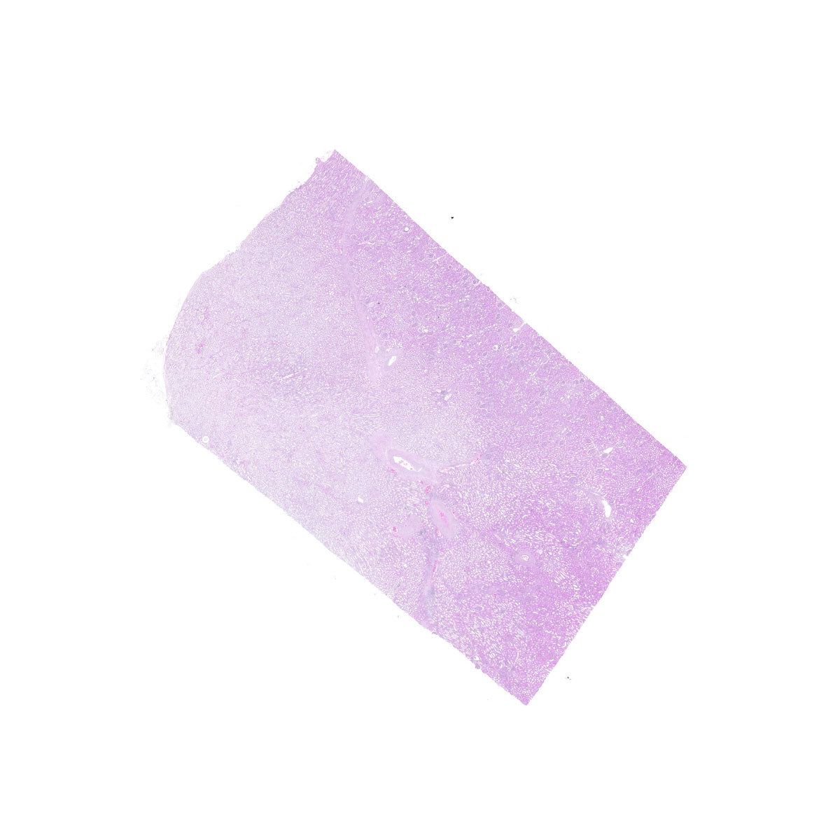 Human FFPE NAT Kidney Tissue HuN-12-0090B