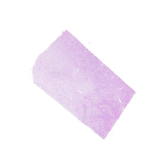 Human FFPE NAT Kidney Tissue HuN-12-0090B