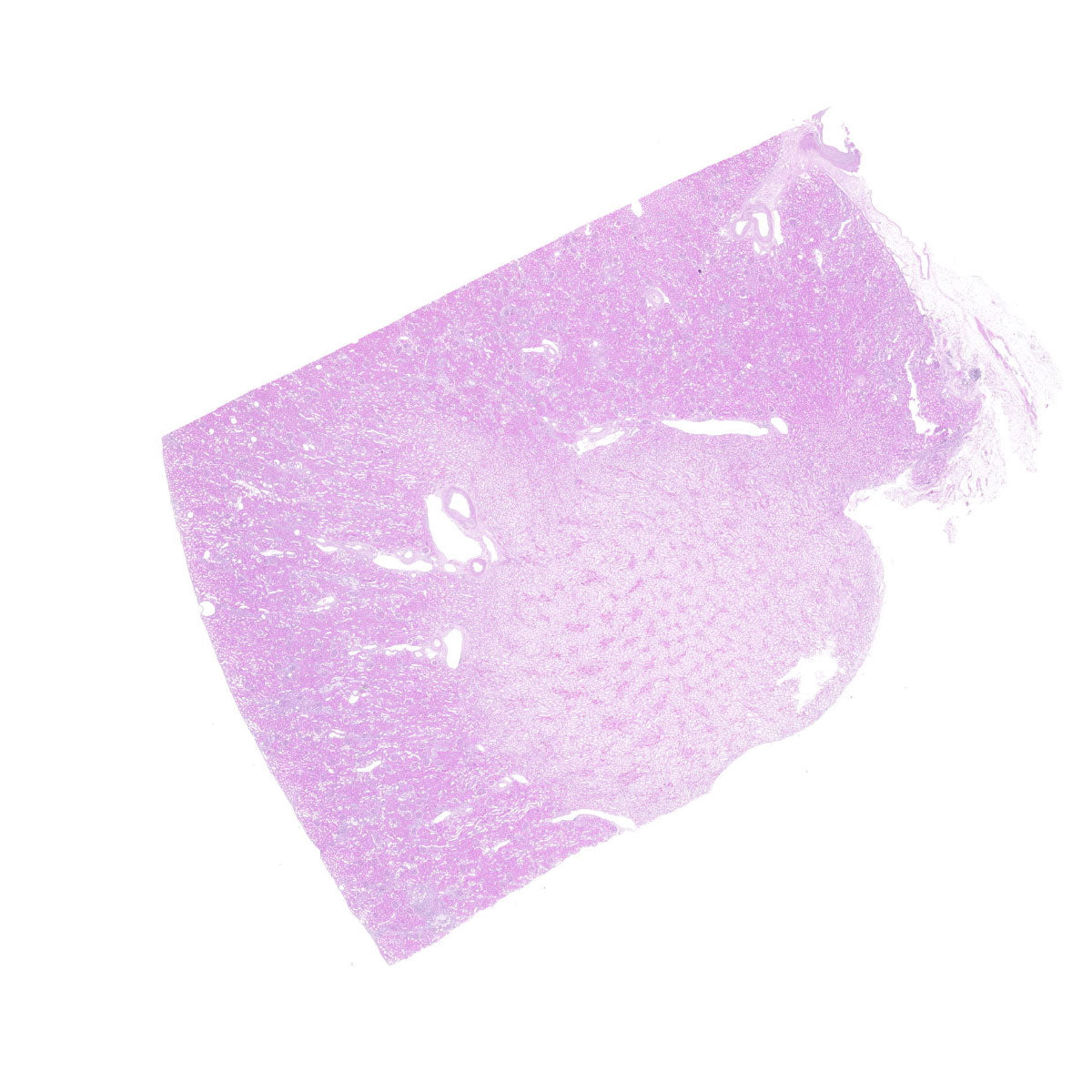 Human FFPE NAT Kidney Tissue HuN-12-0091A