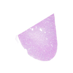 Human FFPE NAT Kidney Tissue HuN-12-0091B