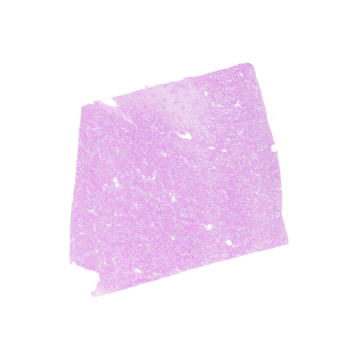 Human FFPE NAT Kidney Tissue HuN-12-0092A