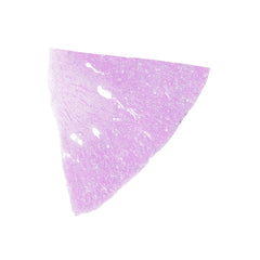 Human FFPE NAT Kidney Tissue HuN-12-0092B