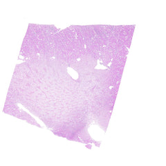 Human FFPE NAT Kidney Tissue HuN-12-0093A