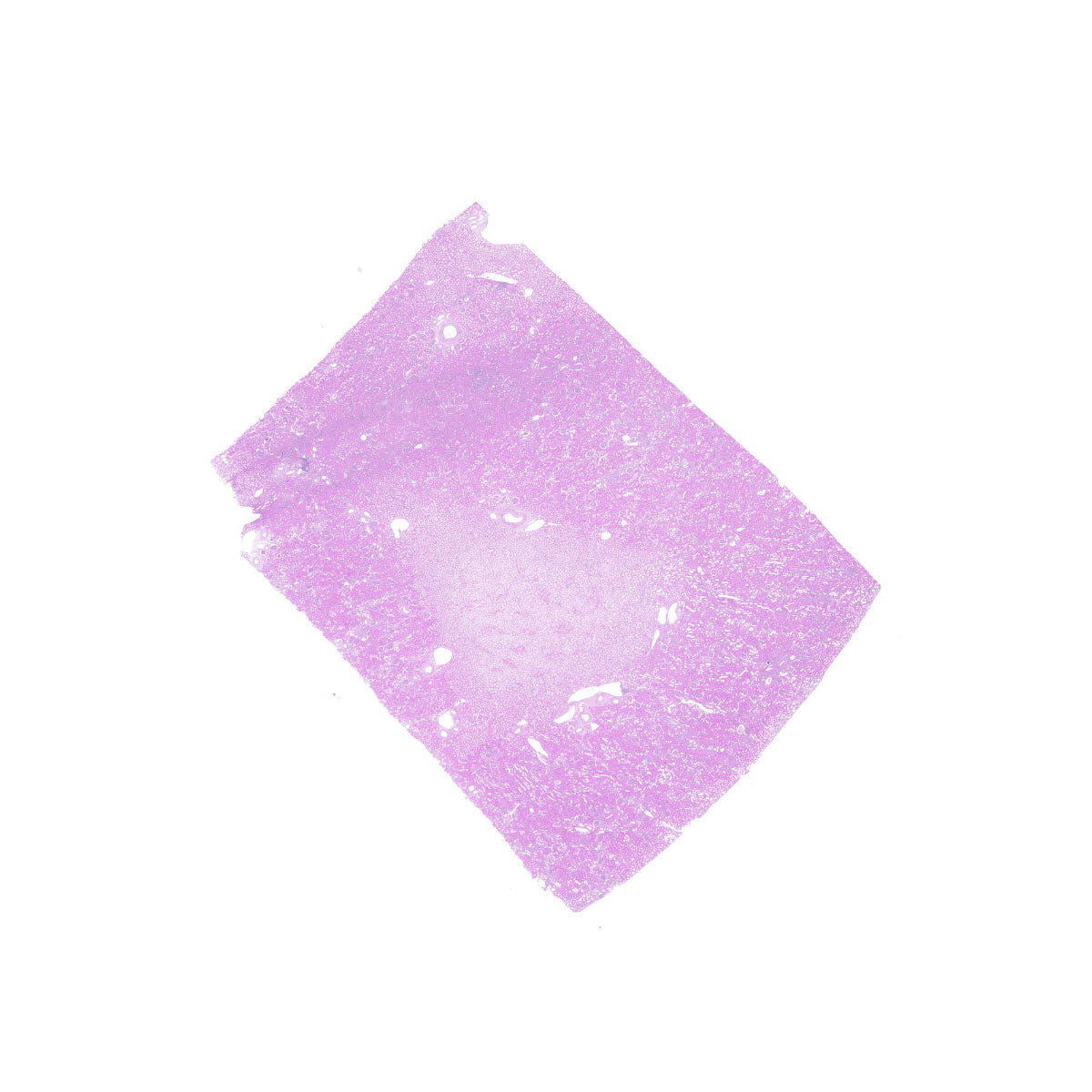 Human FFPE NAT Kidney Tissue HuN-12-0093B