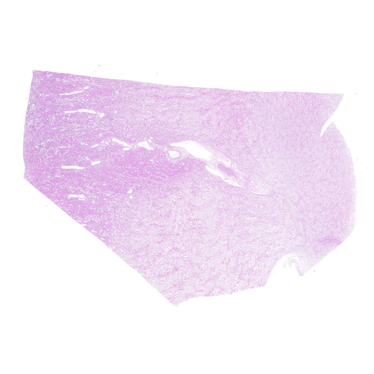 Human FFPE NAT Kidney Tissue HuN-12-0094A