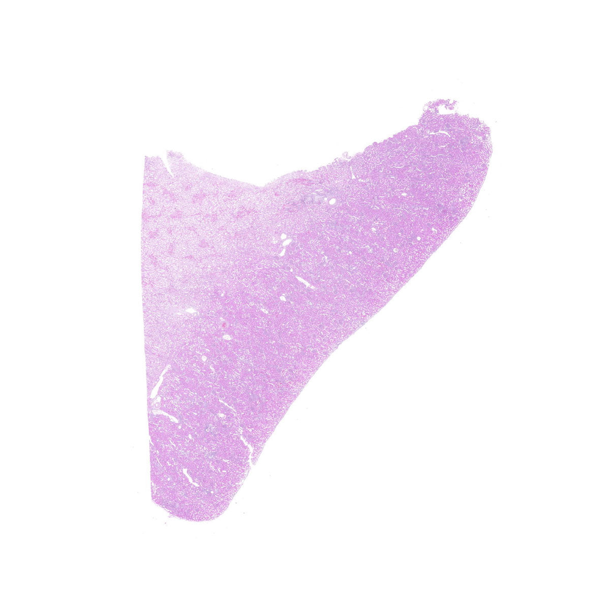 Human FFPE NAT Kidney Tissue HuN-12-0094B